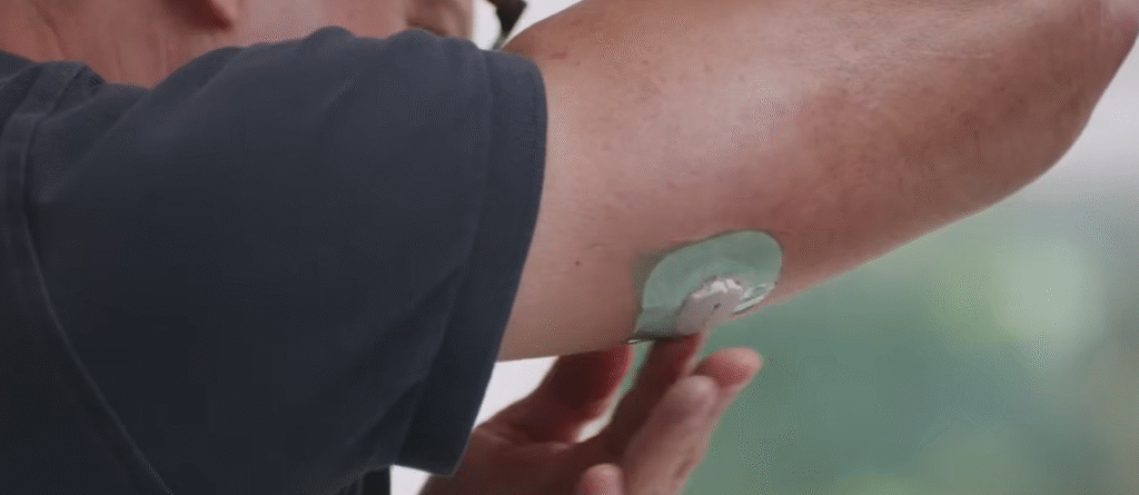 Dexcom G7 Lawsuit Dexcom G7 Lawsuit