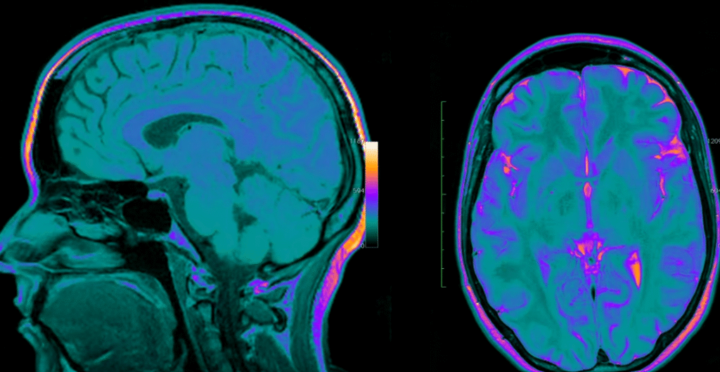 Neuroscience Is Redefining the Science