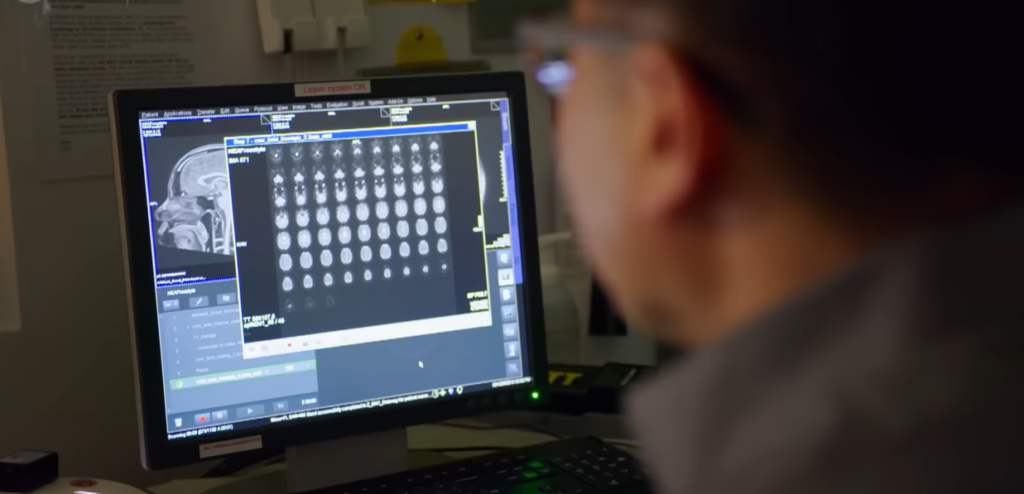 Brain scans show social media rewires memory formation