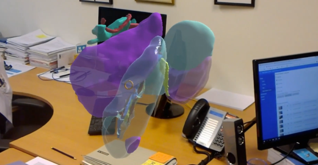 Surgeons use mixed reality to perform first “hologram-guided” operation